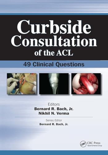Curbside Consultation of the ACL: 49 Clinical Questions (Curbside Consultation in Orthopedics)