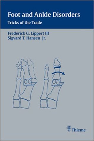 Foot and Ankle Disorders: Tricks of the Trade - Click to Buy