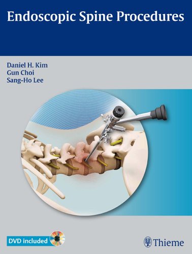 Endoscopic Spine Procedures - Click to Buy