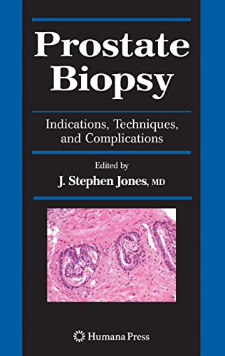 Prostate Biopsy: Indications, Techniques, and Complications - Click to Buy