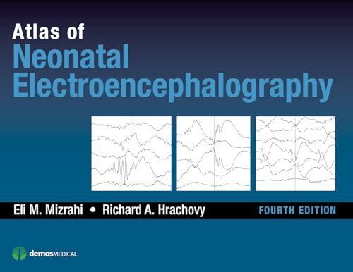 Atlas of Neonatal Electroencephalography - Click to Buy