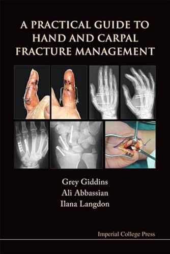 A Practical Guide to Hand and Carpal Fracture Management - Click to Buy
