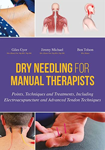 Dry Needling for Manual Therapists: Points, Techniques and Treatments, Including Electroacupuncture and Advanced Techniques - Click to Buy