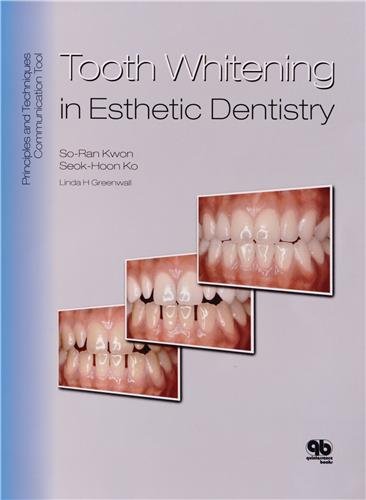 Tooth Whitening in Esthetic Dentistry: Principles and Techniques - Click to Buy
