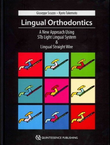 Lingual Orthodontics: A New Approach Using Stb Light Lingual System & Lingual Straight Wire - Click to Buy