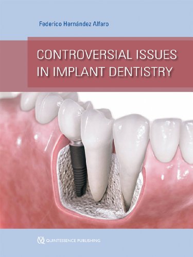 Controversial Issues in Implant Dentistry - Click to Buy