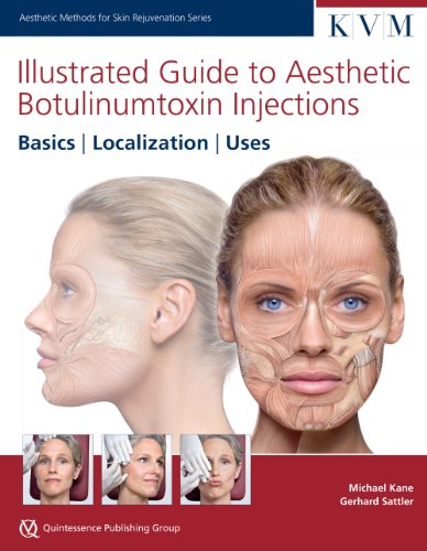 Illustrated Guide to Aesthetic Botulinum Toxin Injections: Basics / Localization / Uses (Aesthetic Methods for Skin Rejuvenation)