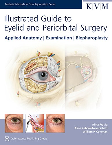 Illustrated Guide to Eyelid & Periorbital Surgery: Applied Anatomy, Examination, Blepharoplasty