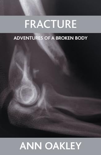 Fracture: Adventures of a Broken Body - Click to Buy