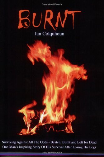 Burnt: Surviving Against All the Odds - Beaten, Burnt and Left for Dead. One Man's Inspiring Story of His Survival After Losing His Legs - Click to Buy