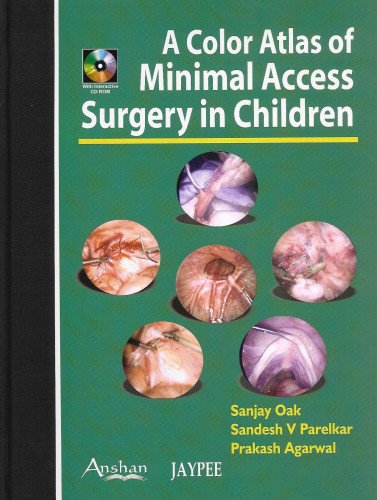 Color Atlas of Minimal Access Surgery in Children - Click to Buy