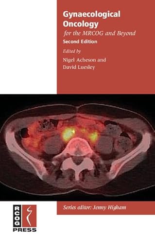 Gynaecological Oncology for the MRCOG and Beyond (Membership of the Royal College of Obstetricians and Gynaecologists and Beyond) - Click to Buy