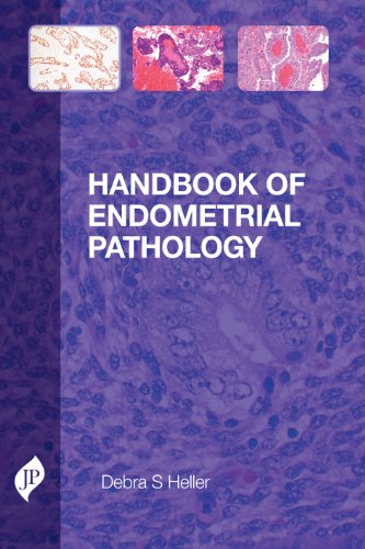 Handbook of Endometrial Pathology - Click to Buy