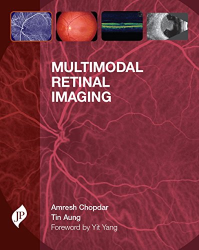 Multimodal Retinal Imaging - Click to Buy