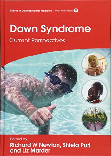 Down Syndrome: Current Perspectives - Click to Buy