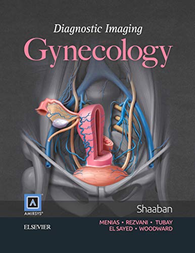 Diagnostic Imaging: Gynecology - Click to Buy