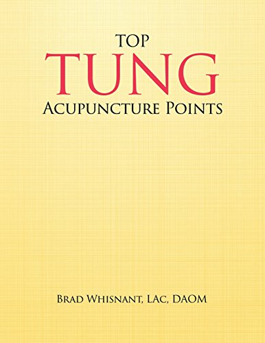 Top Tung Acupuncture Points: Clinical Handbook - Click to Buy