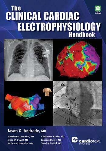 The Clinical Cardiac Electrophysiology Handbook - Click to Buy