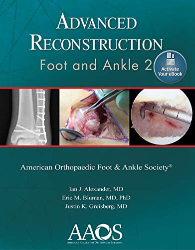 Advanced Reconstruction: Foot and Ankle 2: Print + Ebook (AAOS - American Academy of Orthopaedic Surgeons) - Click to Buy