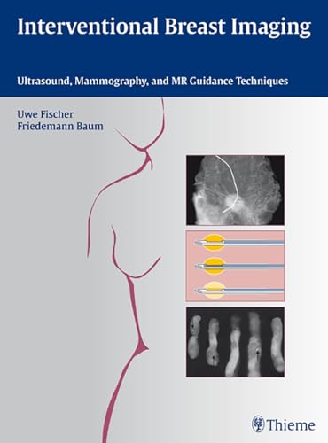 Interventional Breast Imaging: Ultrasound, Mammography, and MR Guidance Techniques - Click to Buy