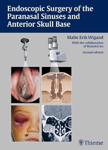 Endoscopic Surgery of the Paranasal Sinuses and Anterior Skull Base - Click to Buy