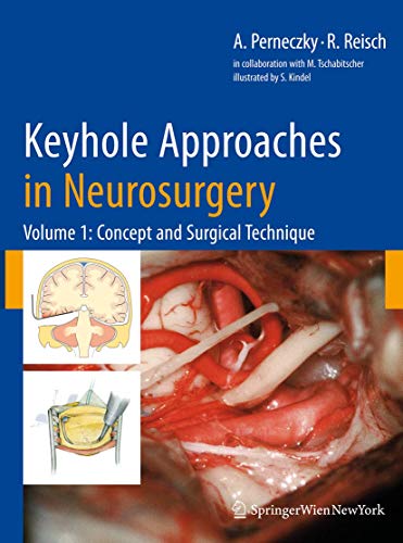 Keyhole Approaches in Neurosurgery: Volume 1: Concept and Surgical Technique - Click to Buy