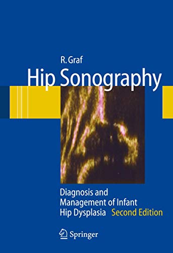 Hip Sonography: Diagnosis and Management of Infant Hip Dysplasia - Click to Buy