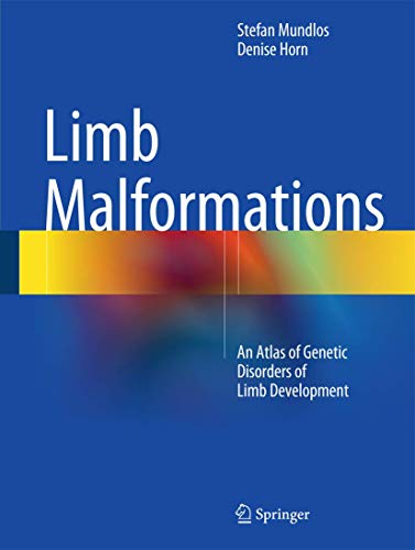 Limb Malformations: An Atlas of Genetic Disorders of Limb Development - Click to Buy