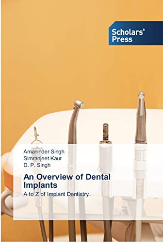 An Overview of Dental Implants: A to Z of Implant Dentistry