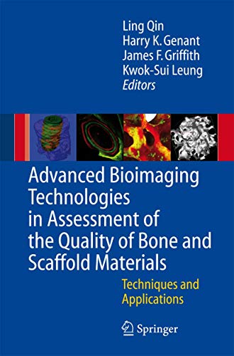 Advanced Bioimaging Technologies in Assessment of the Quality of Bone and Scaffold Materials: Techniques and Application: Techniques and Applications - Click to Buy