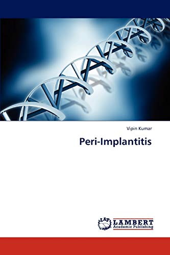 Peri-Implantitis - Click to Buy
