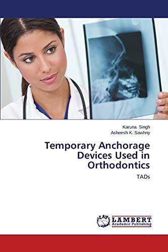Temporary Anchorage Devices Used in Orthodontics: TADs - Click to Buy