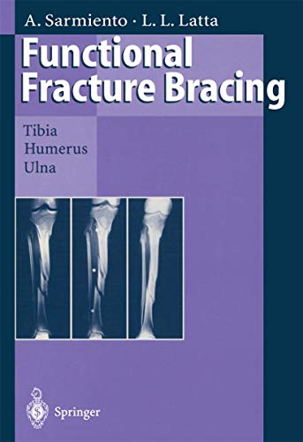 Functional Fracture Bracing: Tibia, Humerus, and Ulna - Click to Buy