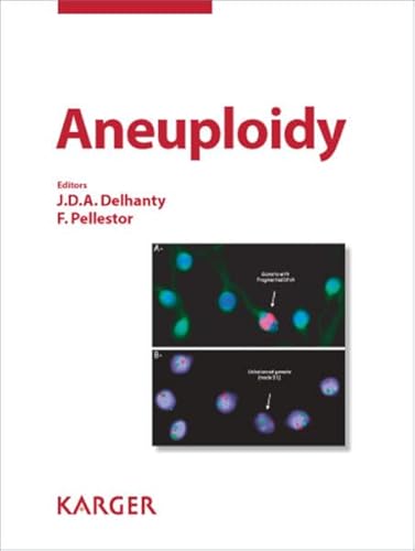 Aneuploidy: Cytogenetic and Genome Research 2011 - Click to Buy