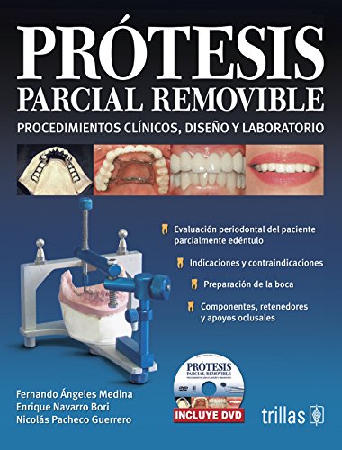 Protesis parcial removible / Removable Partial Denture: Procedimientos clinicos, diseno y laboratorio / Clinical Procedures, Laboratory and Design - Click to Buy