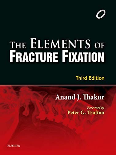 The Elements of Fracture Fixation - Click to Buy