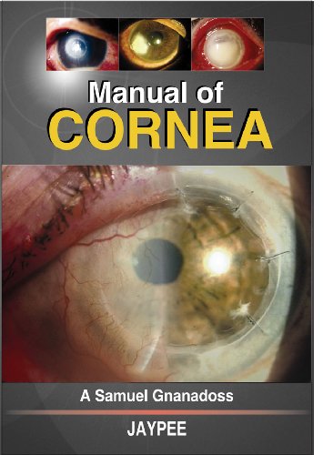 Manual of Cornea - Click to Buy