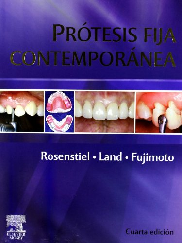 Prótesis fija contemporánea (Spanish Edition) - Click to Buy