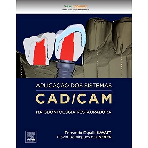 Aplicação dos Sistemas CAD/CAM na Odontologia Restauradora (Em Portuguese do Brasil) - Click to Buy