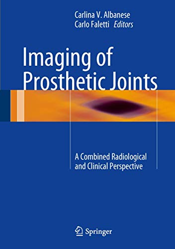 Imaging of Prosthetic Joints: A Combined Radiological and Clinical Perspective - Click to Buy