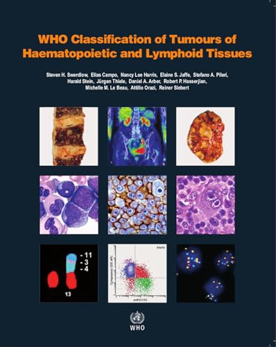 WHO Classification of Tumours of Haematopoietic and Lymphoid Tissues [OP (Volume 2) - Click to Buy