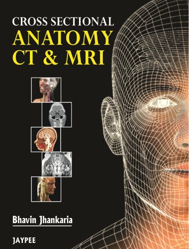Cross Sectional Anatomy CT & MRI - Click to Buy