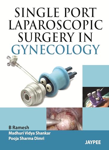 Single-Port Laparoscopic Surgery in Gynecology - Click to Buy