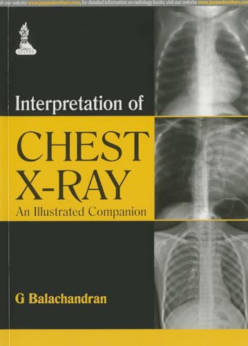 Interpretation of Chest X-Ray: An Illustrated Companion - Click to Buy