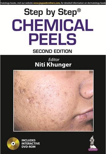 Step by Step Chemical Peels - Click to Buy