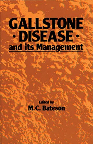 Gallstone Disease and its Management - Click to Buy