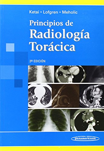 KETAI:Principios Radiolog a Tor cica (Spanish Edition) - Click to Buy