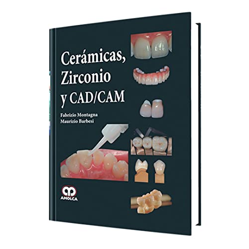 Cerámicas, Zirconio y CAD/CAM (Spanish Edition)