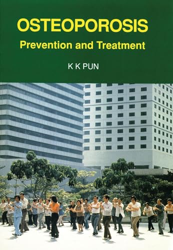 Osteoporosis: Prevention and Treatment - Click to Buy