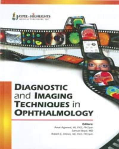 Diagnostic and Imaging Techniques in Ophthalmology - Click to Buy